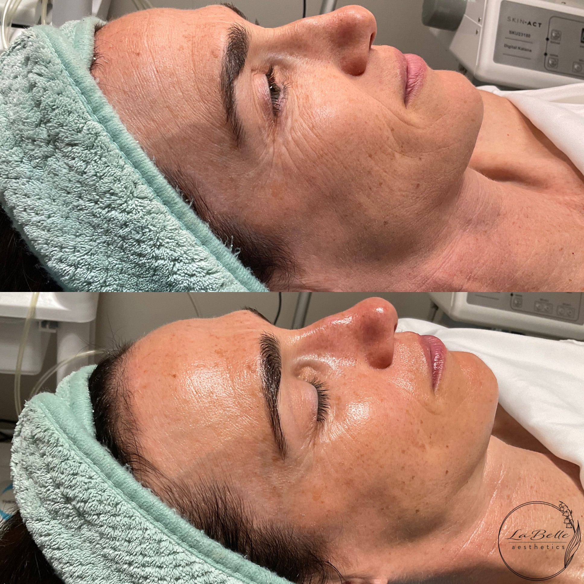 Hydration Restoration
