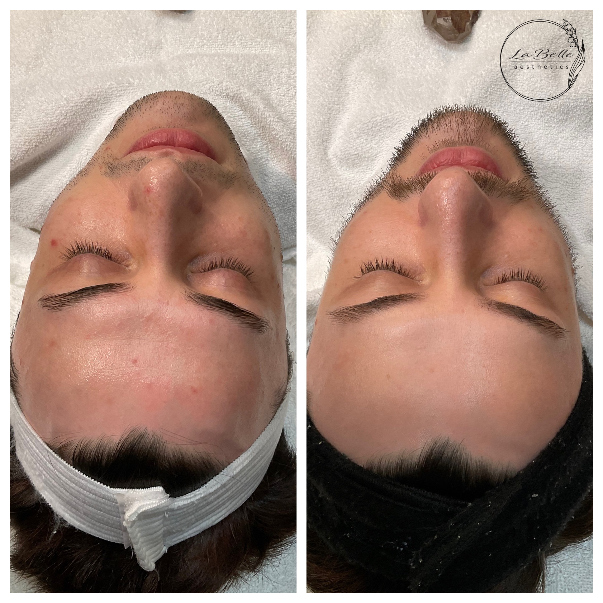 Skin Clarity Journey